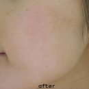 (주)튜링겐코리아 | 수분크림추천 : 반트 36.5 어드밴스드 모이스춰 크림 사용후기