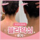임프레스팰리스 | [후기] 부천역 왁싱샵 블리왁싱 내돈내산 후기｜예비신부 뒷목·등·팔 왁싱 후기