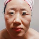 경락관리 이미지