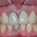 엠웍스 치과기공소 이미지