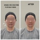 빛나는 에스테틱 네이버블로그