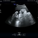 화로상회수유점 | 더현대 크리스마스, 올겨울 첫 딸기 | 35주차 임산부 ootd