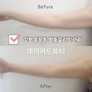 김포 풍무동 에스테틱 레이어드뷰티 팔뚝슬리밍관리 하루만에 효과본 후기