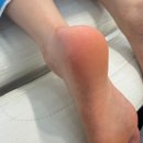 레푸스연신내점 | [연신내] 발 피부 관리를 위한 '레푸스 연신내점' 솔직한 후기