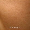아르네브 이미지