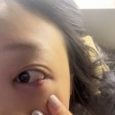 밝은최안과의원 이미지