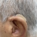 수원보청기 이미지