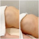제이로운 | 부산 명지피부관리 임신준비 IBA 궁테라피 솔직후기 피부로운 에스테틱