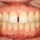 부산예스치과의원 이미지