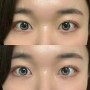 렌즈미 신상 축고정 렌즈 클로아 베리팝·베이지팝 내돈내산 후기