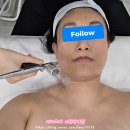 수원-1593 | 수원피부관리 더라르떼 스킨가드닝 후기 인계동 피부관리 원탑 찾았어요