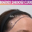 중앙헤어라인 이미지