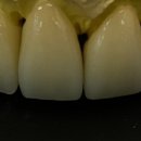 뉴치과기공소 이미지