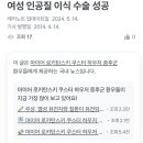 트젠들 질 이식수술은 왜 안한대 이미지