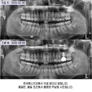 네오연세치과의원 네이버블로그