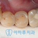 이하루치과 이미지