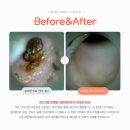 코너동물병원 | 코너동물병원 외이염 치료 후기 모음