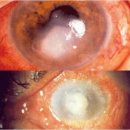 아이메디케어 이미지