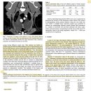 CT attenuation value를 통한 pleural effusion의 감별 이미지