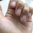 네일밭 | 오호라 네일 강화제 손톱영양제 4주 사용 후기