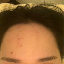 동양파라곤 앞 | 반송동 피부샵, 맞춤피부관리 + 하체후면관리 1시간 집중케어 후기