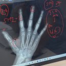 연세밝은아이치과의원 | 용인 연세바로치과 용인점