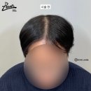 레이븐스칼프