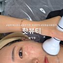 푸라닭 광주화정점 | 광주 잡티관리 잘하는곳 핫뷰티 주근깨 색소관리 솔직후기 (1)