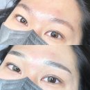 아네프의원 | 구리눈썹문신 확실하게 잘하는곳