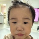 진심어린이집 | 어린이집 상담 후기, 아이 얼굴 긁힌 사건