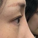 브로우블라썸 | 시흥대야동 속눈썹펌 맛집 찾았다 브로우블라썸 C컬 후기