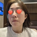 리바이브 | 벨로테로 리바이브 스킨부스터 후기 통증(수피부과)