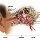 우리소리보청기 이미지