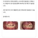 하치과의원 | 내돈내산 소아치아교정 상담 임플라인치과의원 치아노트어플