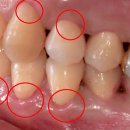 상아플란트치과 이미지