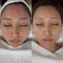 아로마무드랩 | 합정피부관리 | 마이디스킨랩, 합정예신관리 스피큘 관리 색소침착 개선 후기