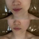 끌리네 | 전주윤곽관리]효자동작은얼굴관리/전주신부관리/스페셜작은얼굴관리후기::'끌리네피부관리 신시가지효자점'