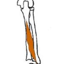 장모지신근(extensor pollicis longus) 이미지