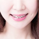 서울민플러스치과의원 네이버블로그