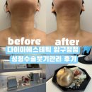 차의과학대학교 임상약학대학원 | 다이아에스테틱 압구정점 성형수술붓기관리 후기