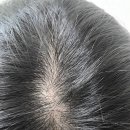 블루메드 | 스칼프메드 블루 솔트 샴푸 일주일 사용후기