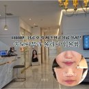 서인천의료기 | 송도피부과 올리디아 볼륨으로 꺼진 볼살 모공탄력 살려본 찐후기!