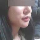 에스탑성형피부 네이버블로그