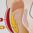 춘천내장 이미지