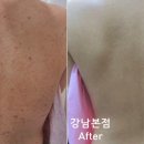 강남리유한의원 네이버블로그