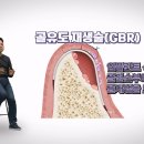 인사이드 이미지