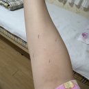 으라차차 유도짐 모라점 | [임신 기록] 구세 산부인과 39주 임산부 초산모1박 2일 유도 분만 후기