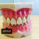 상아치과 네이버블로그