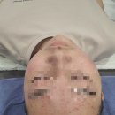 (주)서동메디칼 롯데백화점(대전점) | 대전 레비덤 여드름 관리 학생 여드름 관리 탄방동피부관리 후기 올려요~