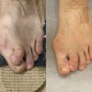 통탈의원 네이버블로그